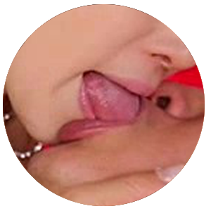 キス・ベロチュー