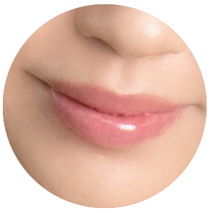 ノーメル唇